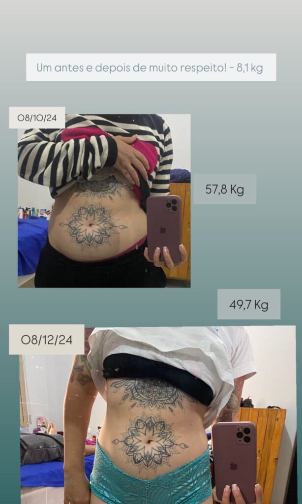 A imagem mostra uma paciente com endometriose que perdeu 8kg